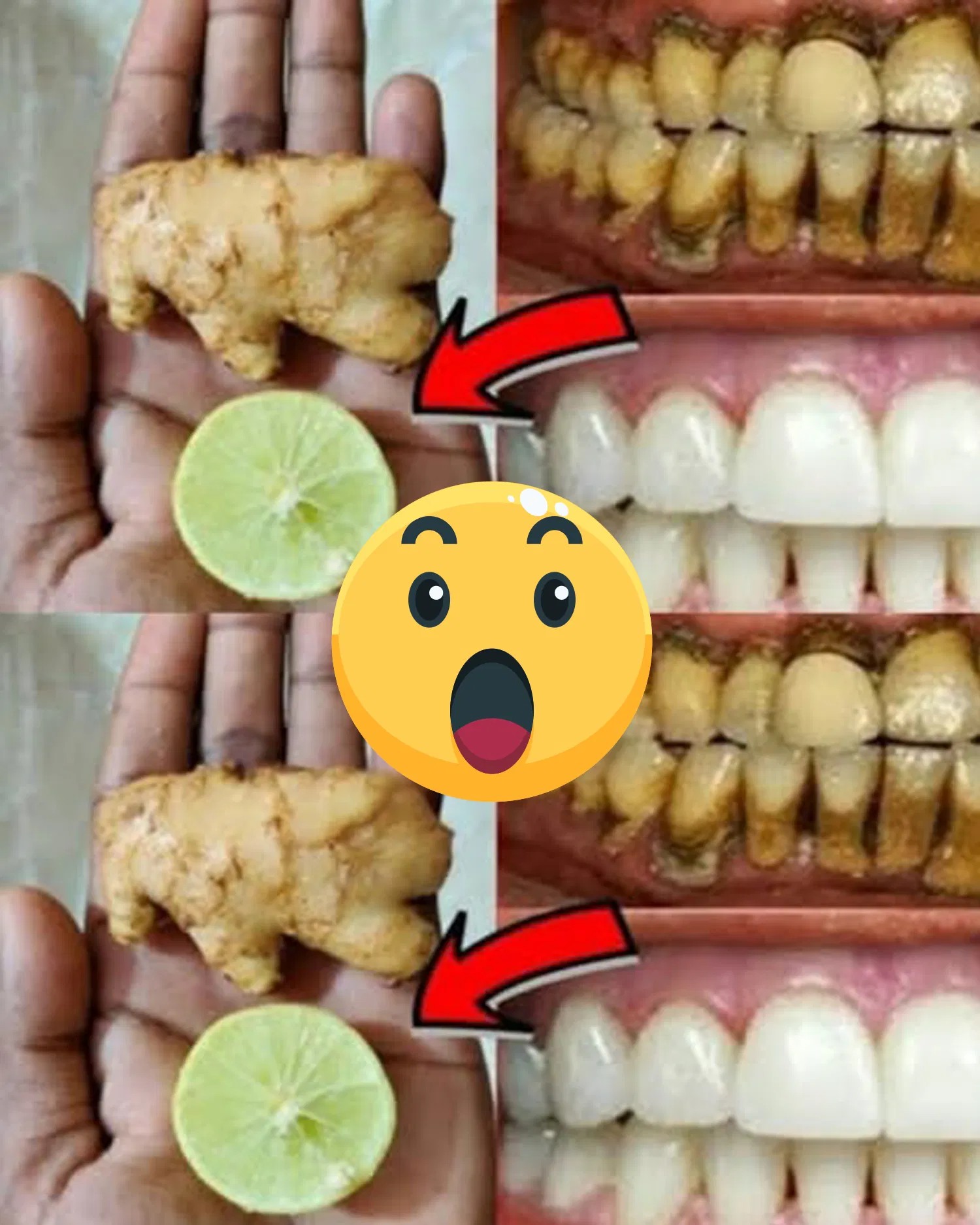 This Recipe Will Turn Yellow Teeth White Like Pearls!  Ginger & Lime Teeth Whitening Hack