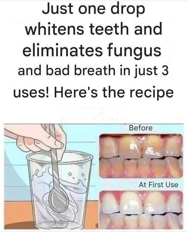 Remove tartar from your teeth and whiten them with this simple recipe