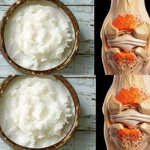 Foods to Rebuild Knee Cartilage: A Complete Guide & Recipe