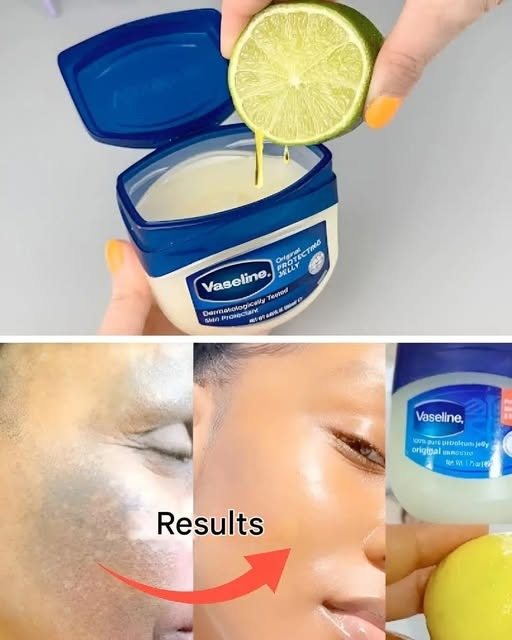 Vaseline and Lemon: The Home Trick for Sublime Skin