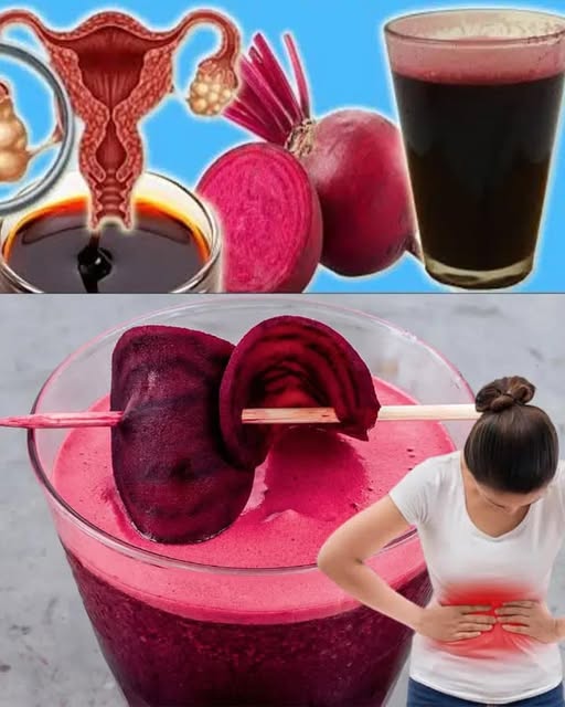 Beetroot: A Natural Remedy for Fibroids and Cysts