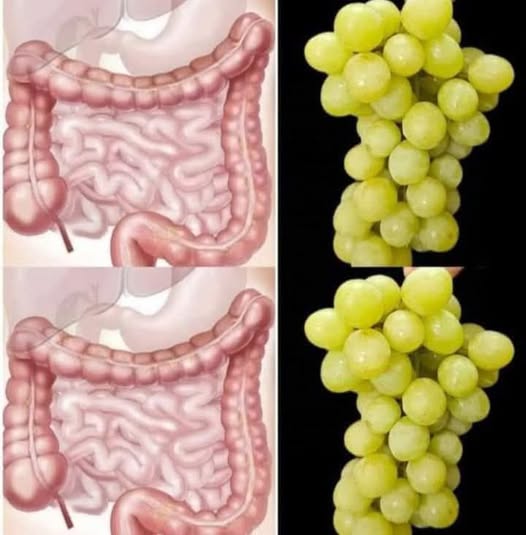 Intestine and Liver Are Like New! Just 3 Days with Grapes – All the Dirt Comes Out