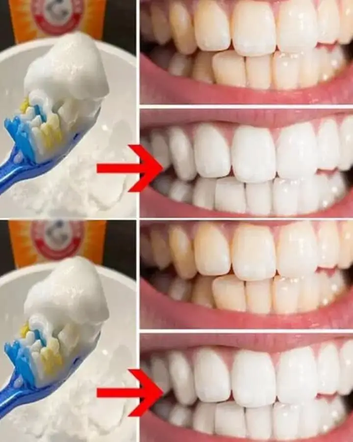 Natural trick to get rid of unsightly tartar stains from teeth