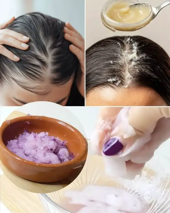 How to Use Vaseline for Hair Growth: Two Effective Recipes for Thicker, Longer Hair