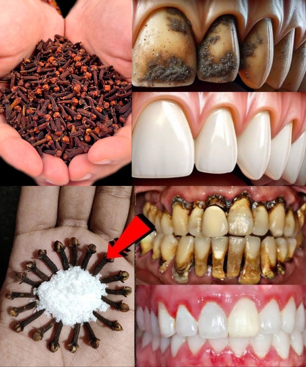 Unlock the Secret to Healthier Teeth with the Oral Care Benefits of Chewing Cloves Daily